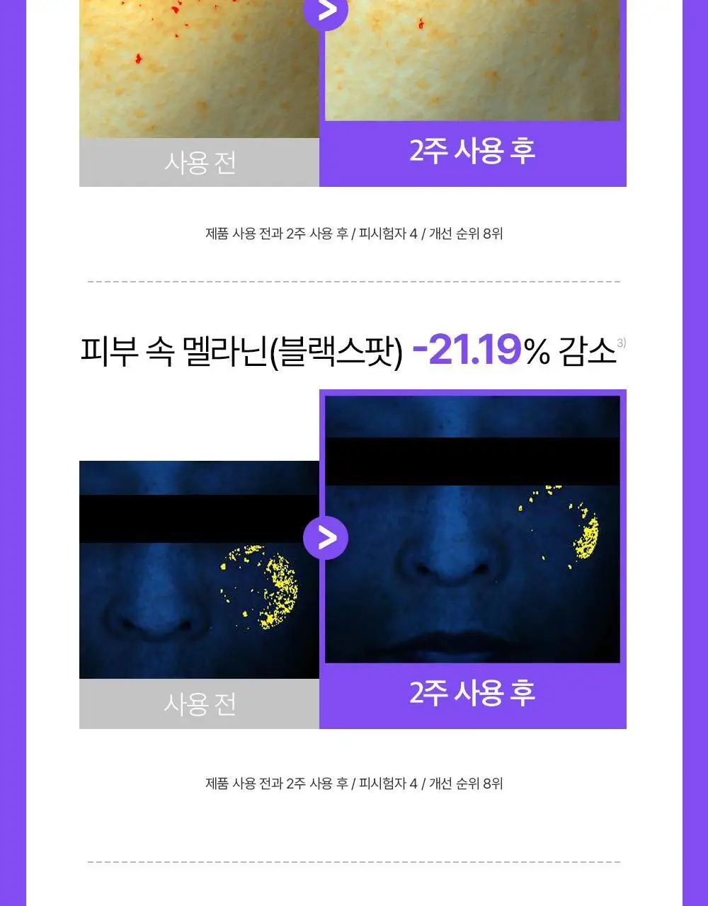 [흔적케어크림] 더마펌 수딩 리페어 토닝 크림 R4 50ml 기획 (+30ml) 상세페이지 23